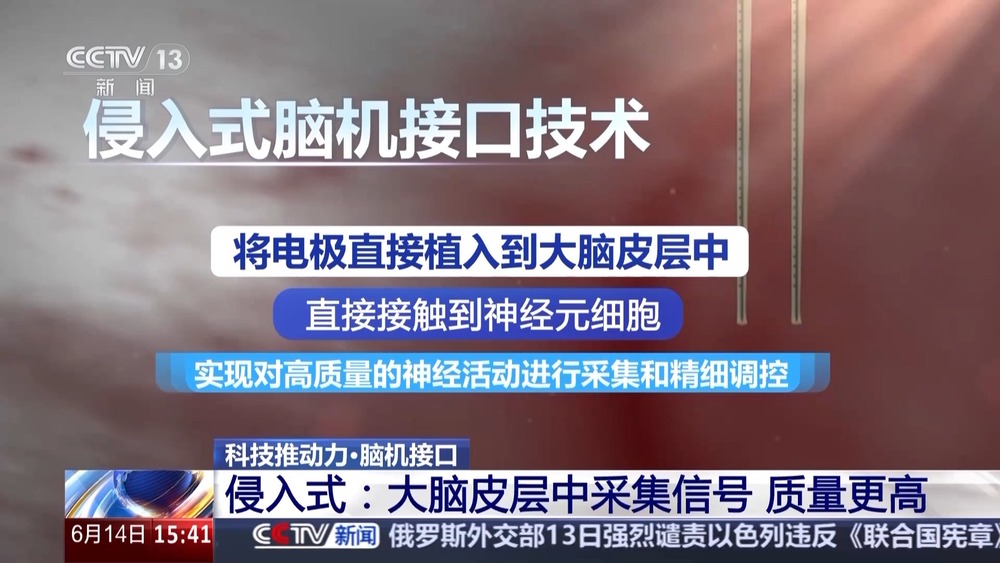 用意念下象棋！脑机接口快速发展 “人机共生”照进现实(图5)