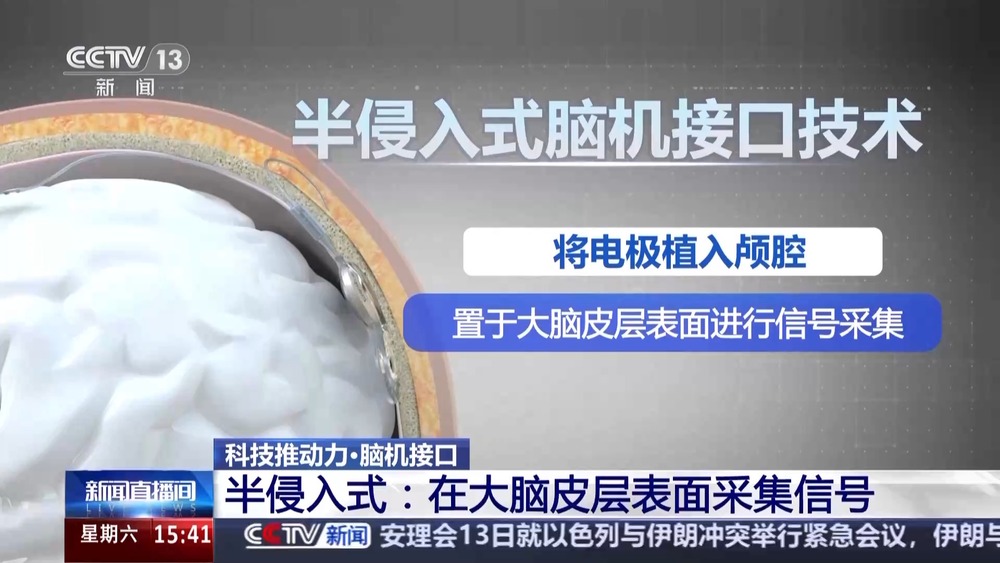 用意念下象棋！脑机接口快速发展 “人机共生”照进现实(图4)