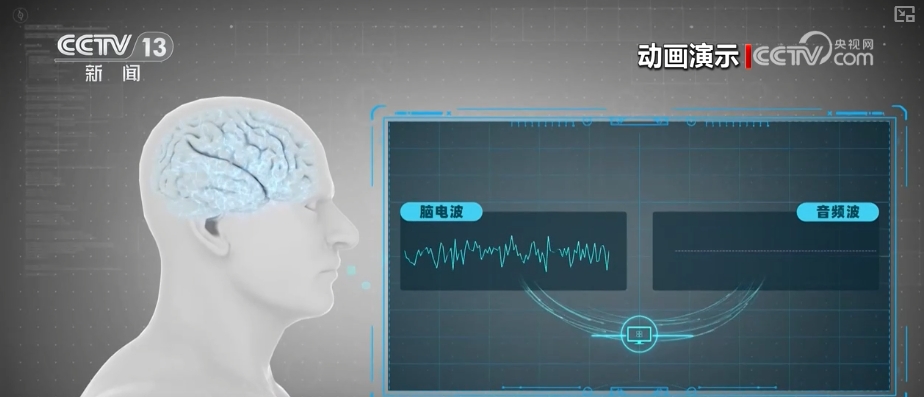 脑机接口创新成果不断涌现 脑机“加速跑”突破数十亿元市场规模(图3)