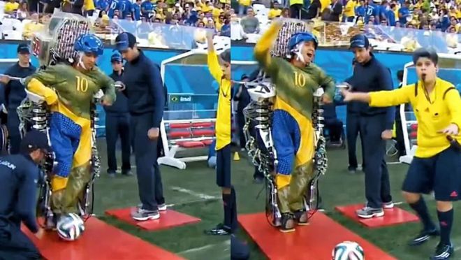 脑机接口：开启人类未来新纪元(图3)