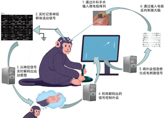 脑机接口：开启人类未来新纪元(图4)