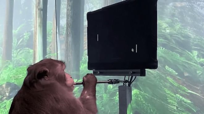 脑机接口：开启人类未来新纪元(图5)