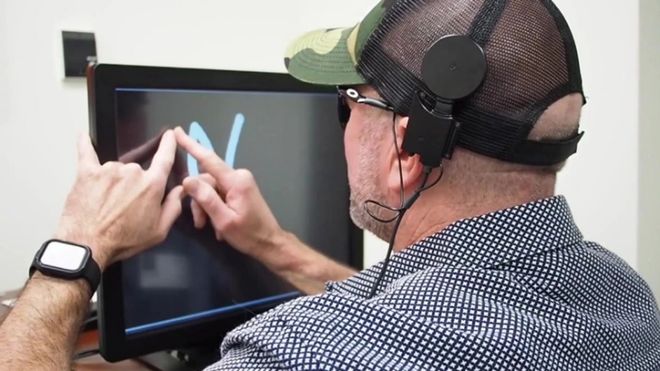 脑机接口：开启人类未来新纪元(图7)