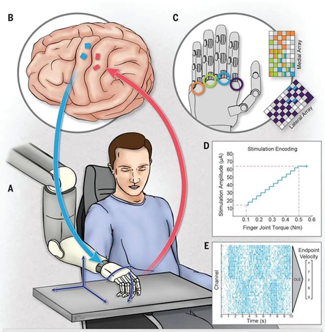 脑机接口：开启人类未来新纪元(图6)