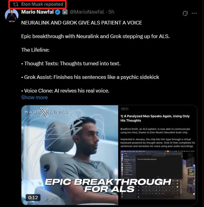 马斯克脑机技术实现盲人复明及意念操控！“肉身成神”时刻来了？(图4)