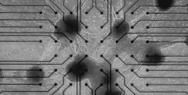 马斯克脑机技术实现盲人复明及意念操控！“肉身成神”时刻来了？(图3)