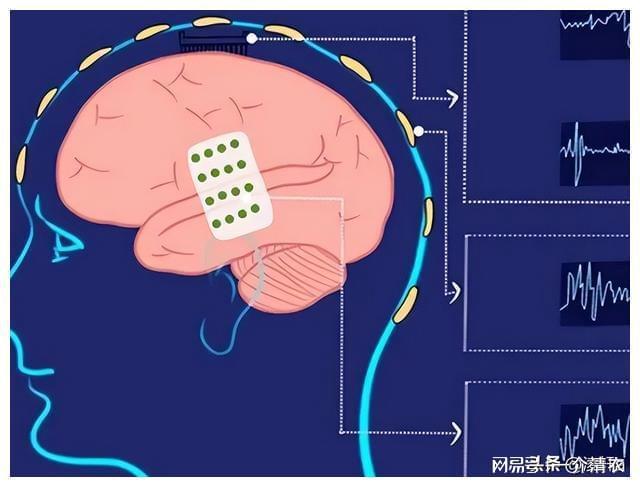 脑接口技术的原理是什么？对虚拟现实技术的发展有何好处？(图10)