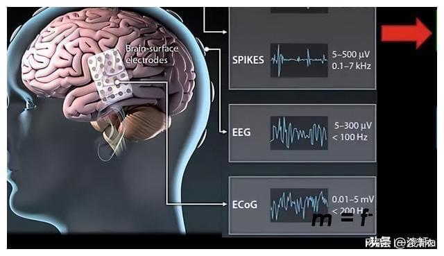 脑接口技术的原理是什么？对虚拟现实技术的发展有何好处？(图14)