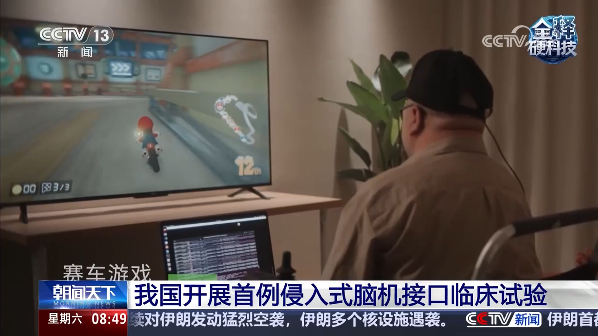 我国首例侵入式脑机接口临床试验成功开展(图1)