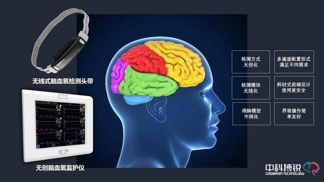 强脑科技监测头环引领智能健康管理的未来浪潮(图1)