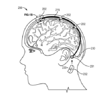 脑机接口：好家伙！神奇的意念之术要实现了吗？(图5)