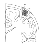 脑机接口：好家伙！神奇的意念之术要实现了吗？(图6)