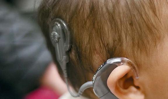 什么是脑机接口它又是如何工作的？(图4)