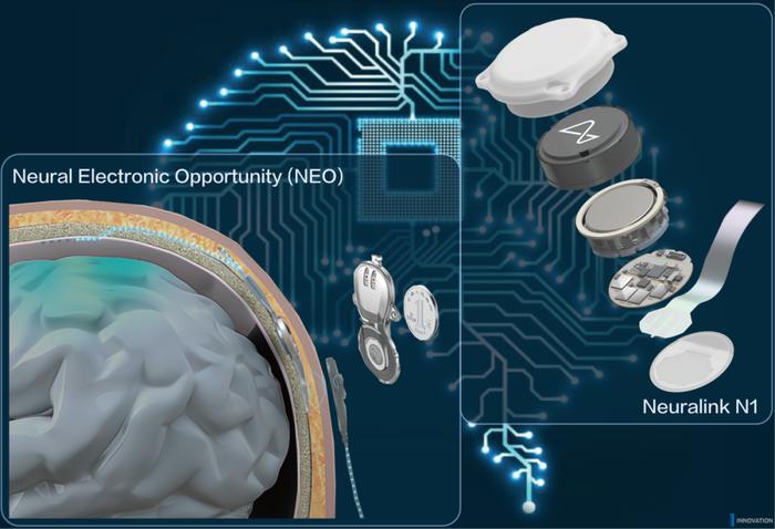 脑机接口收费机制初显 国家医保局：技术获批后可快速进入临床应用(图1)