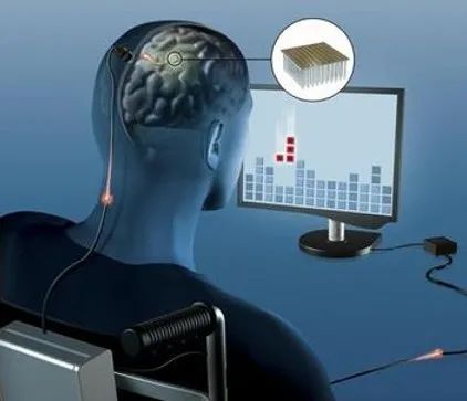 科学家开发出标记技术NeuM 可实时监测神经元的变化(图1)