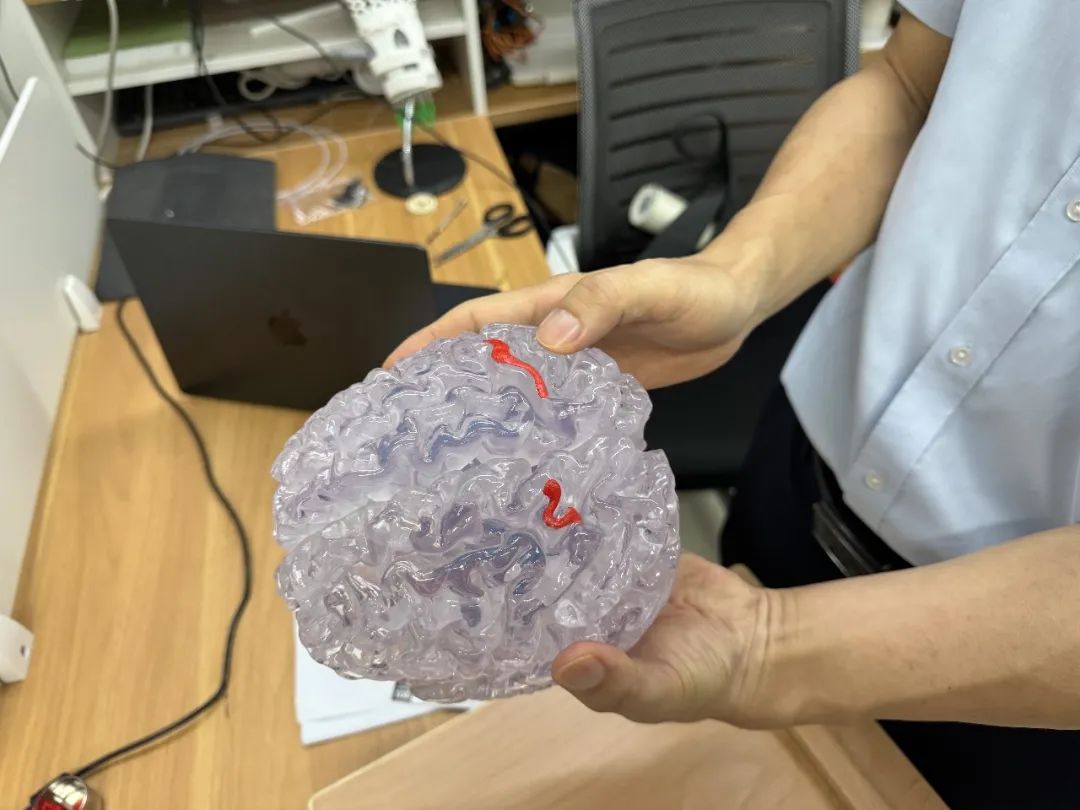 一线调查！瘫痪者、失明者的“救命稻草”？脑机接口门诊爆满背后的真相(图3)