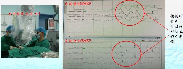 脑机交互与人机共融海河实验室核心企业 ——中电云脑推出国芯脑机智能头环(图1)
