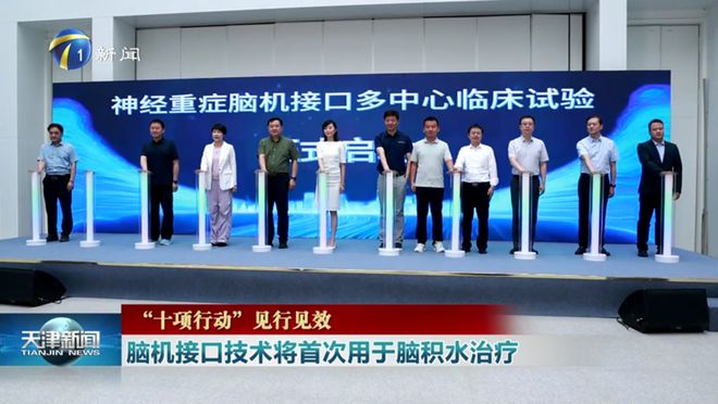 媒体聚焦｜《天津新闻》报道：脑机接口技术将首次用于脑积水治疗(图2)