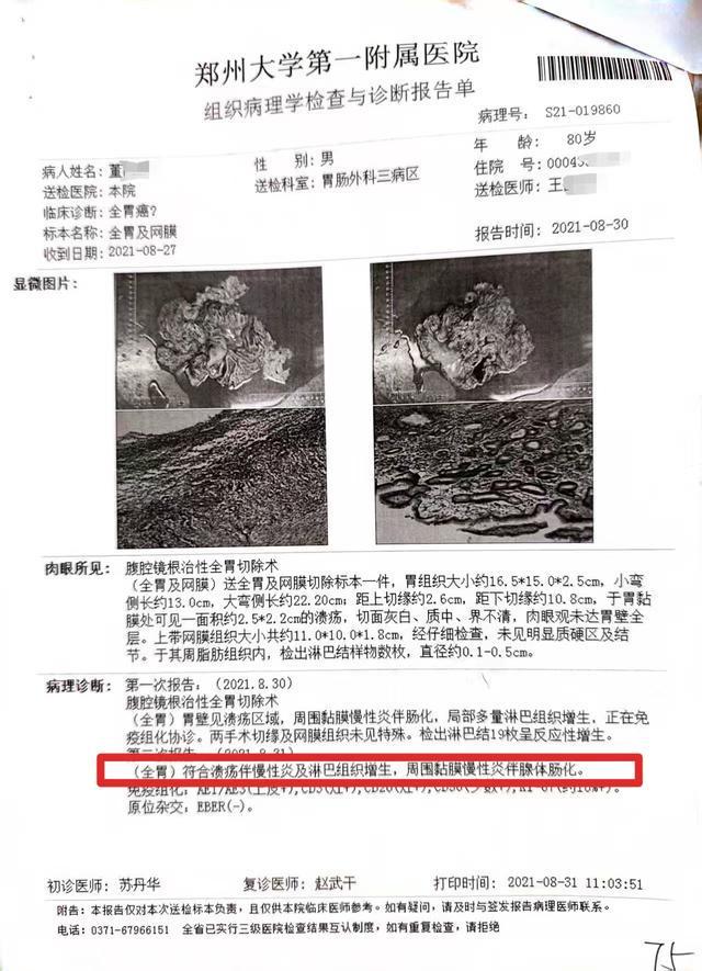 医生左右不分把支架装进正常输尿管三名医生医疗事故仅处罚一助手(图6)