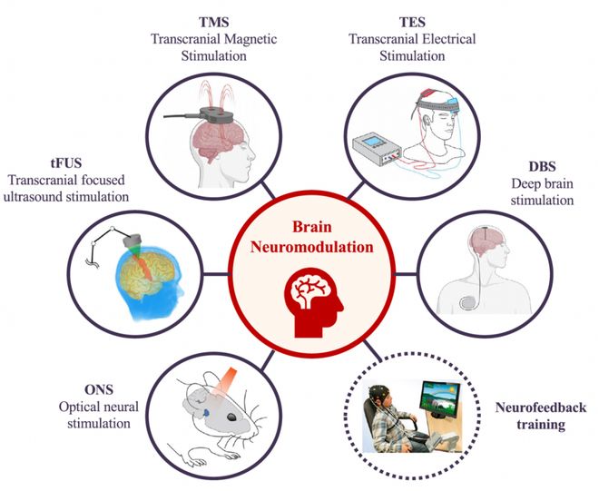 「脑机接口」系统综述发布：全景解析理论、技术、挑战、趋势(图12)
