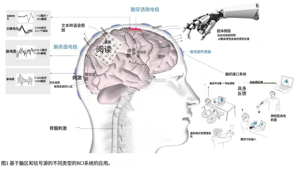 BCI-T：综述 2023-2024全球脑机接口技术进展及临床应用(图2)