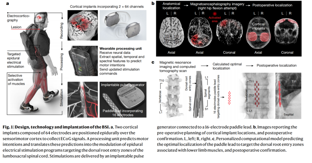 BCI-T：综述 2023-2024全球脑机接口技术进展及临床应用(图10)