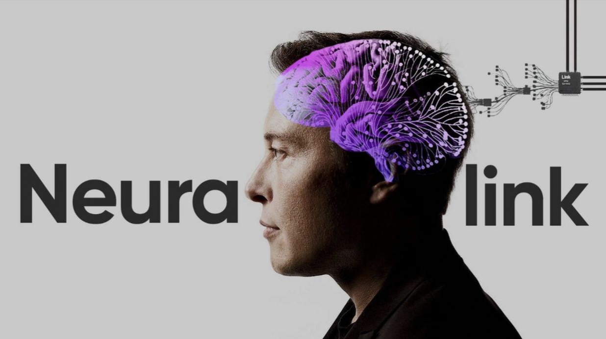 精准切瘤不影响运动功能 脑机接口辅助医生完成清醒开颅手术(图1)