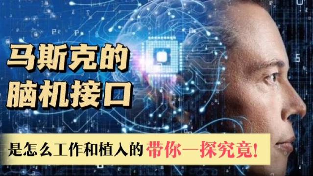 15秒植入！马斯克脑机接口公司技术新突破 超万人等待上脑(图1)