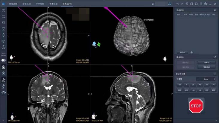 爱朋医疗：公司布局了多模态ADHD行为训练系统(图1)