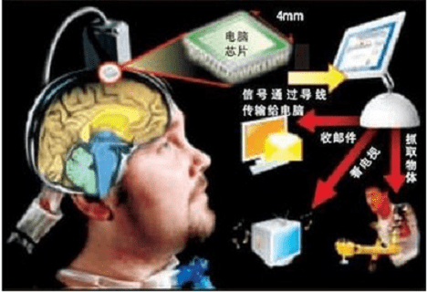 脑机接口技术将来有可能取代实体药物 为了治疗疾病一些患者不得不面对药物副作用对肝肾等脏器的影响。这样的局面可能会通过脑机接口技术找到新解！中国科学院脑科学与智能卓越创新中心赵郑拓研究员表示他们正在探索不依赖治疗神经系统疾病的性。有朝一日这类患者就不用再吃实体。人类距离这天还有多远？(图1)