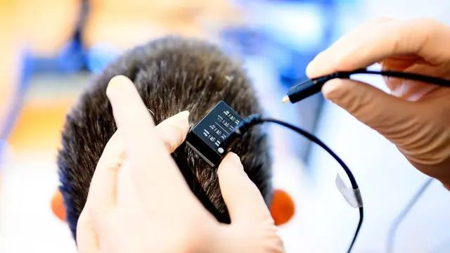 脑机接口2025：政策定调、技术破局、资本涌入 医疗率先落地(图1)