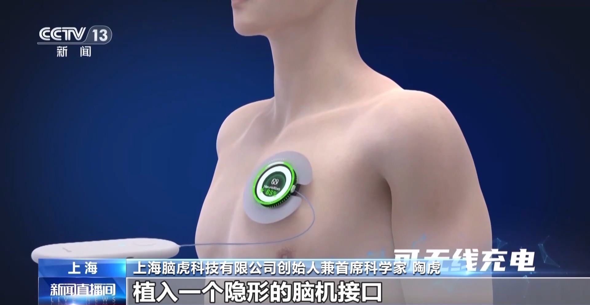 当脑机接口走进生活会为我们带来哪些新可能？(图2)