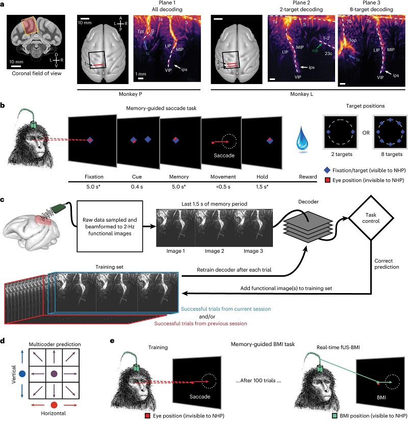神经监测技术在肿瘤外科手术中的应用THE APPLICATION OF(图1)