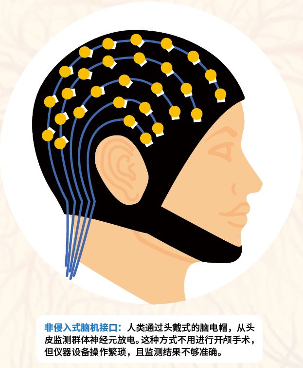 脑机接口技术如何让意识发声？(图4)