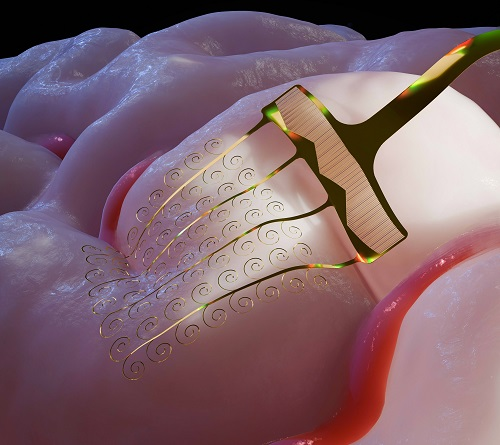 智冉医疗首席科学家领衔破解Neuralink掉“线”难题筑牢侵入式脑机接口核心技术壁垒(图1)