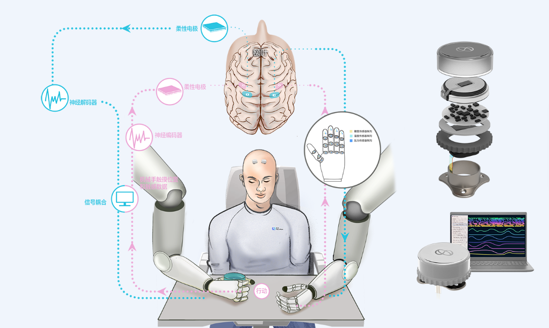 脑机接口系列报告：Neuralink带来的启示(图1)