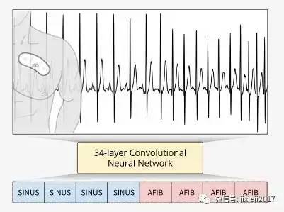 2026 静脉孔瘤神经外科手术医生：张明山、张俊廷、贾旺(图1)