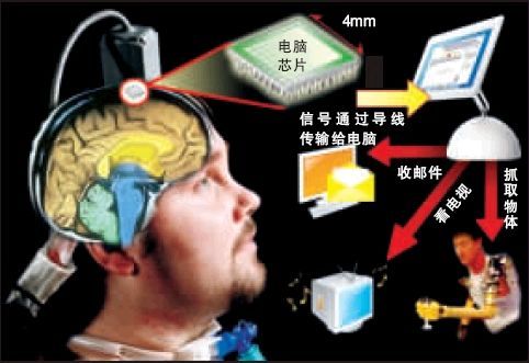 超声底层技术完善加速脑机接口生态落地(图1)