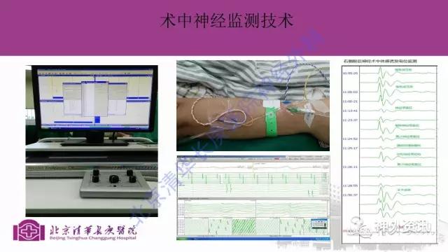 冲刺“脑机接口第一股”！博睿康科创板IPO获得受理拟融资25亿元(图1)