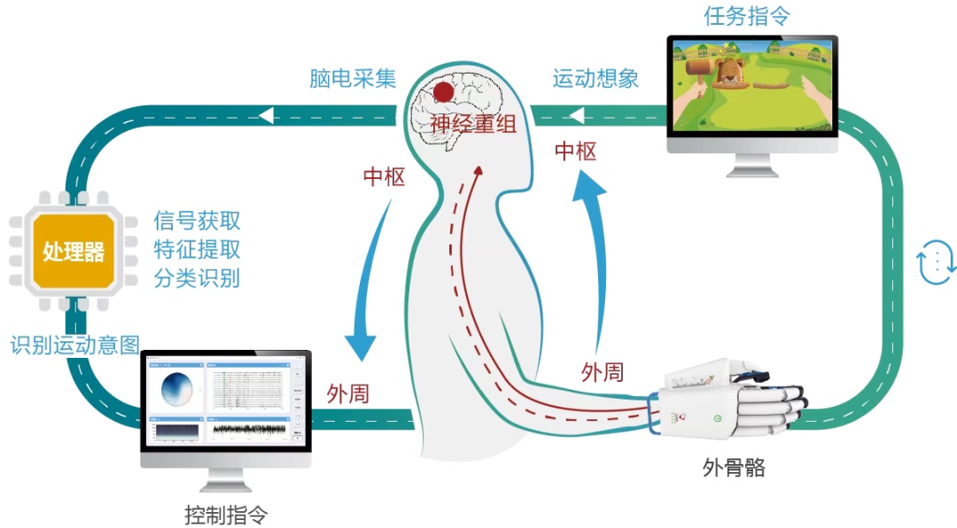 关乎人类未来的“脑机接口”目前四川各大医院有哪些临床研究和转化？(图1)